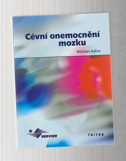 Cévní onemocnění mozku